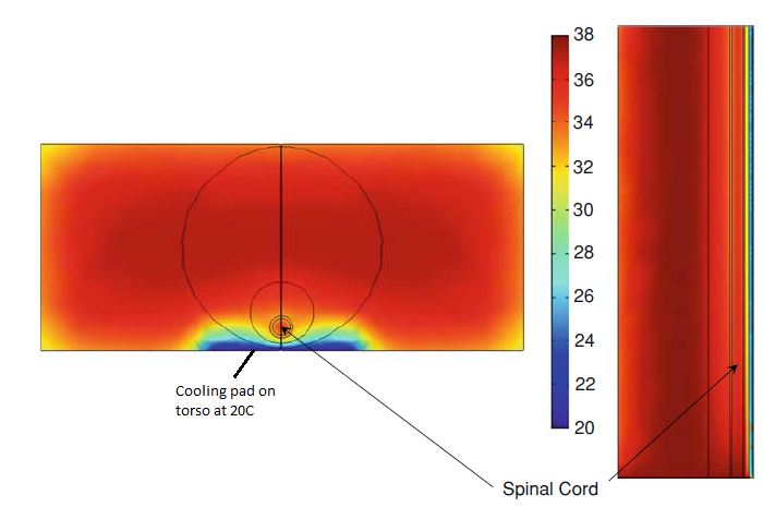 Image_spinal_cord_cooling